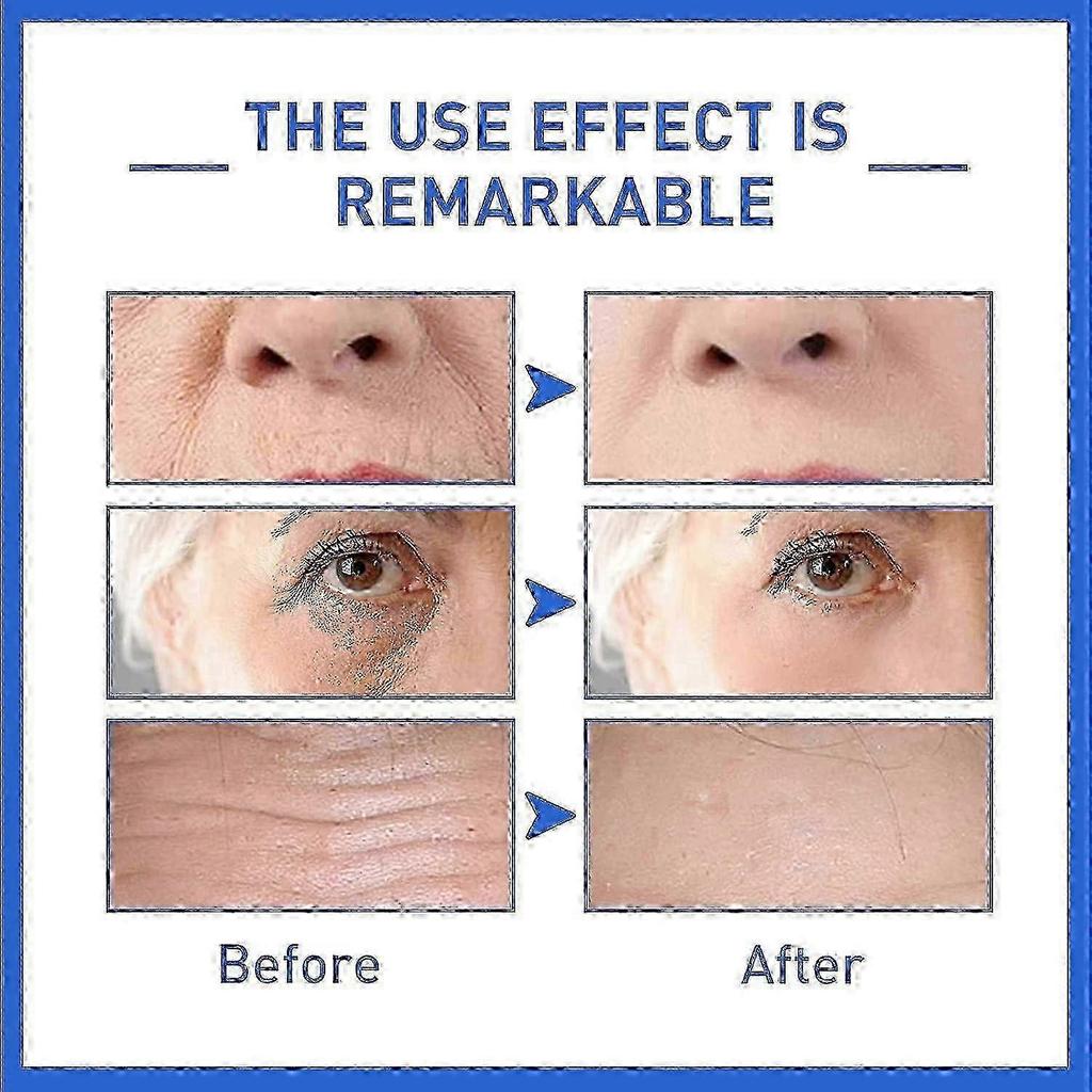 3pcs Anti-Aging Serum,Botoxlux Face Serum Collagen Boost Anti-Wrinkle Serum for Women&Men,Fade Fine Lines Essence_lsmpk