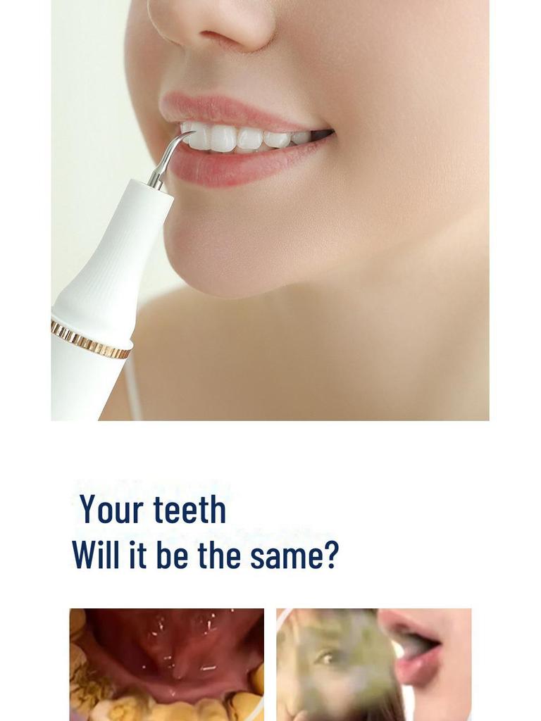 Electric Ultrasonic Tooth Cleaner: Removes Tartar, Smoke Stains, Polishes, and Beautifies Teeth.