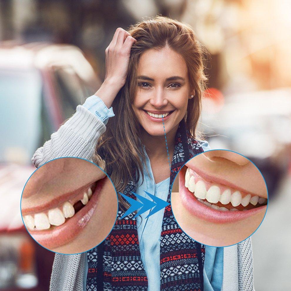 Buy WST 3pcs Temporary Tooth Kit Natural Veneer Replace Missing Teeth