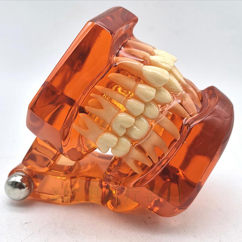 Zahnmedizinisches Lehr-Modell Ortho Metall/Keramik Mit/Ohne Bracket Zahnmedizinische Zubehörteile Kieferorthopädie Zahnersatz Modellierwerkzeug