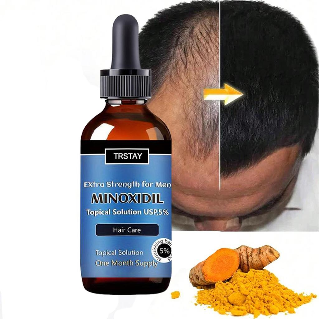 Africký divoký zázvor Esenciální olej pro růst vlasů Šílené řídnutí Místa Vypadávání Růst Okraje Vlasy Trakce Vlasy Alopecie Prevence K3X4