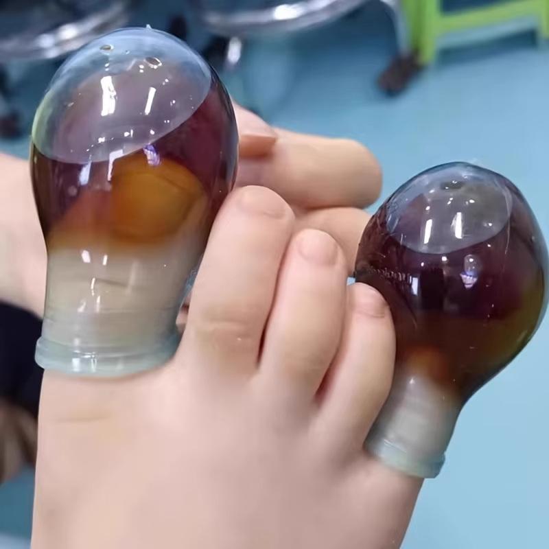 Soft Silicone Toe Sleeves Toe Protectors, Reduce Friction Prevents Nail Insertion For Wound Care And Cutaneous Infections