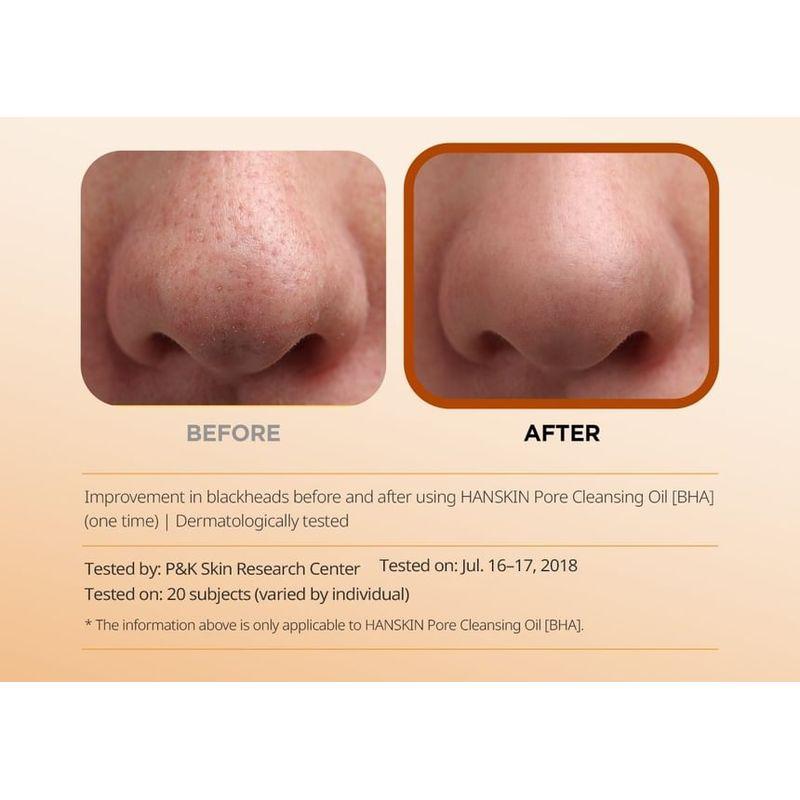 Hanskin - Pore Cleansing Oil BHA