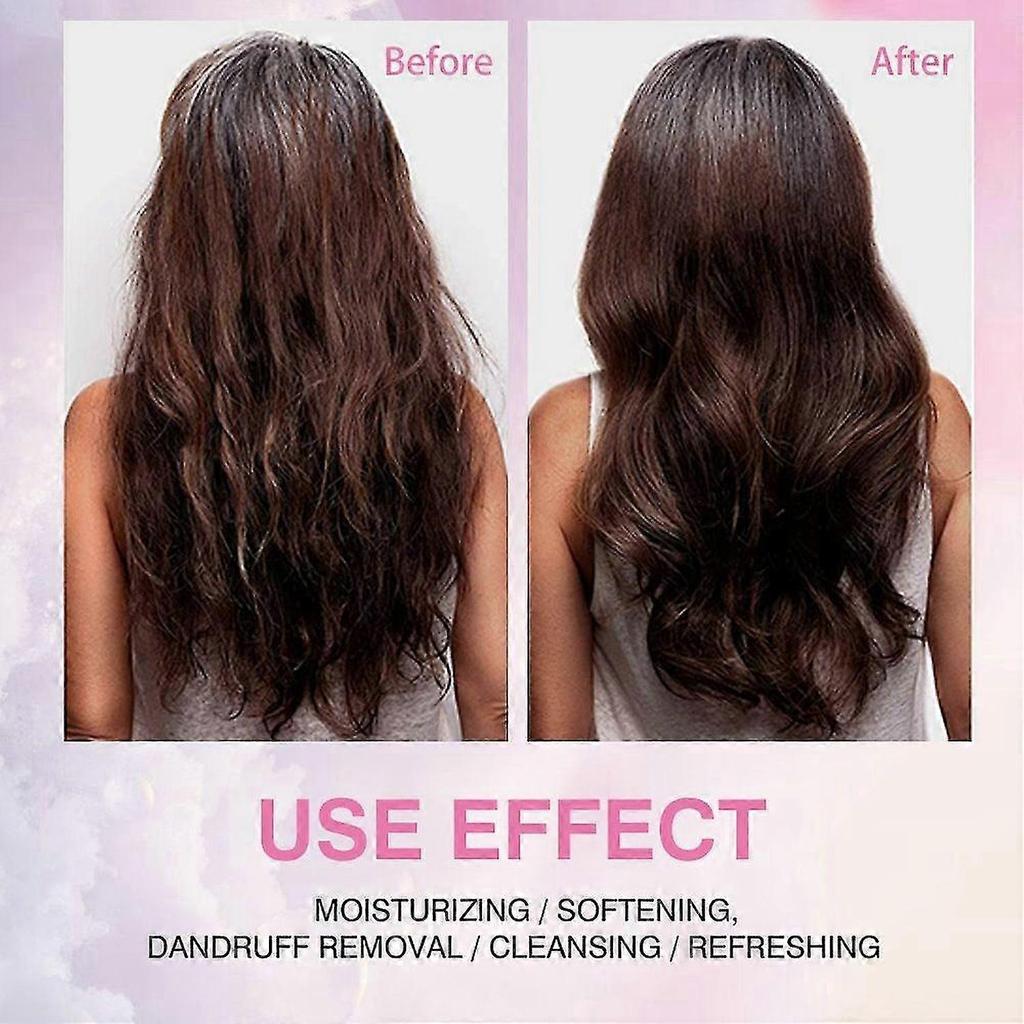 Onion Biotin & Rosemary Shampoo Conditioner Set, Natural Hair Care, Growth Shampoo Suitable for All Hair Types, Relieving Hair Loss, Promoting Hair Gr