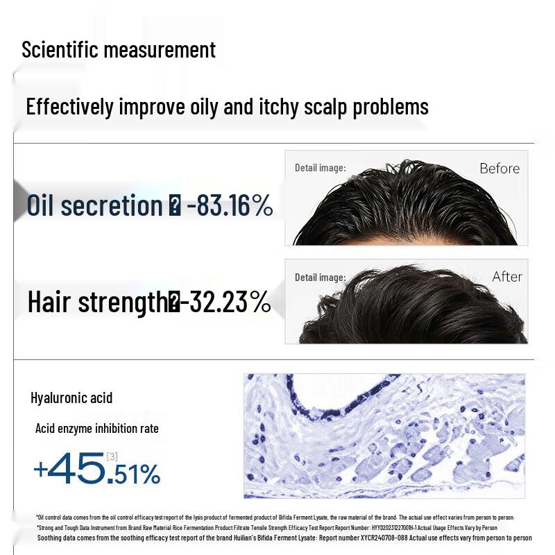 Long Hair Xiaozhai Men's Scalp Care Shampoo
