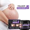 EELHOE Scar Removal Cream Gel Remove Acne Spots Treatment Stretch Marks Burn Surgical Scar Repair Cream Smoothing Whitening Skin Beauty 50g
