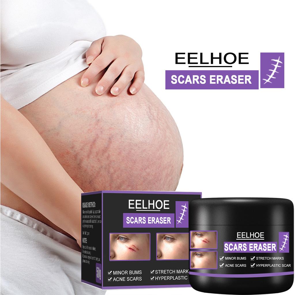 EELHOE Scar Removal Cream Gel Remove Acne Spots Treatment Stretch Marks Burn Surgical Scar Repair Cream Smoothing Whitening Skin Beauty 50g