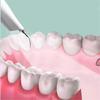Dog Plaque And Tartar Remover, Ultrasonic Teeth Cleaner For And Cats, Ultrasonic Dental Kit, Dental