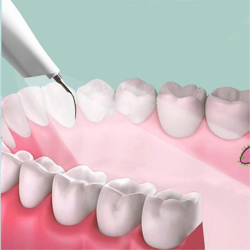 Dog Plaque And Tartar Remover, Ultrasonic Teeth Cleaner For And Cats, Ultrasonic Dental Kit, Dental