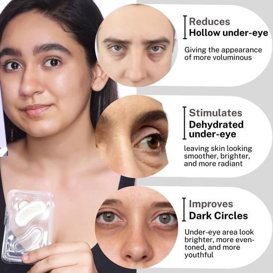 HOUSE OF BEAUTY Instant Filler - Dissolvable Patches 0.25mm for Skin, Face Glow, Dark Circles, Fine Lines, Under Eye (2 Pairs)