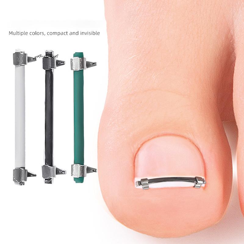 Ingrown Toenail Pedicure Tool - Curved Clamp Toe Nail Care Straightening Correction Clip for Toes - Embed Nail Care Tool