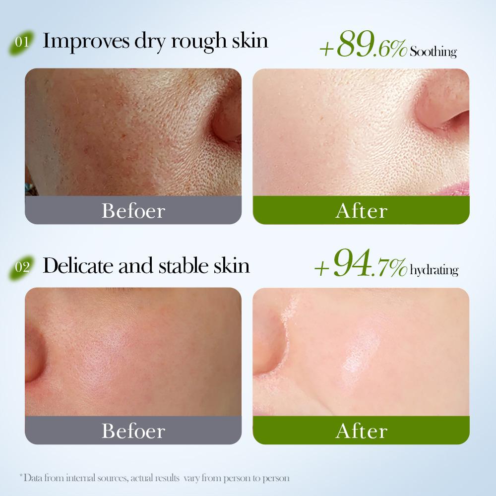 SADOER Avocado Hydrating Nourishing Soothing Mask Hydrating Mask