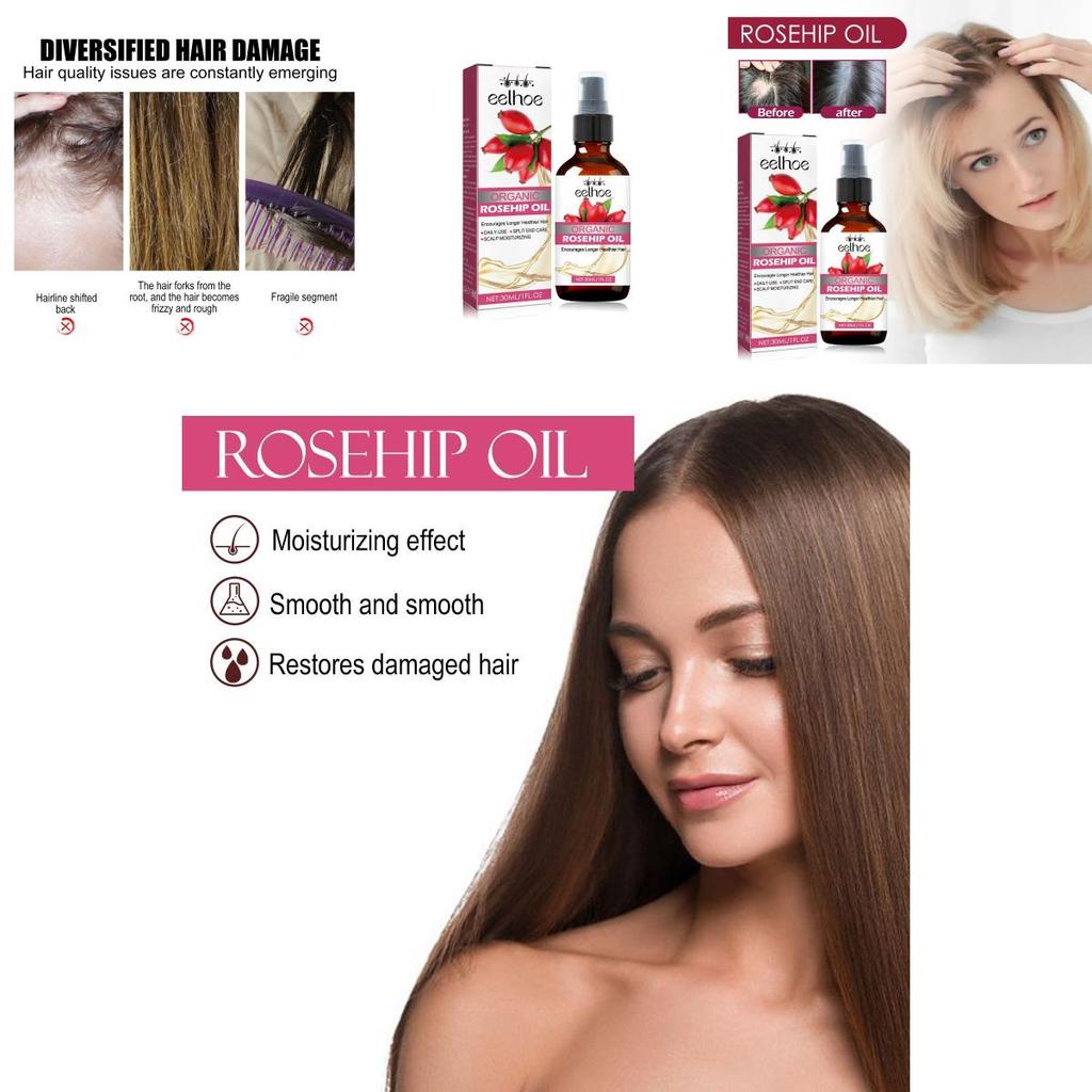 Eelhoe Nourishing Rosehip Oil For Hair Moisturizing And Strengthening 30ml Bottle