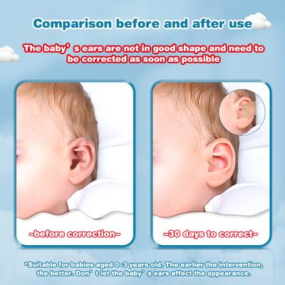 1 Rolle 4 cm x 0,5 m Baby-Ohrenkorrektor Säugling abstehende Ohren Korrektur Silikon Kinder Ohren Ästhetische Korrektoren Pflaster Aufkleber