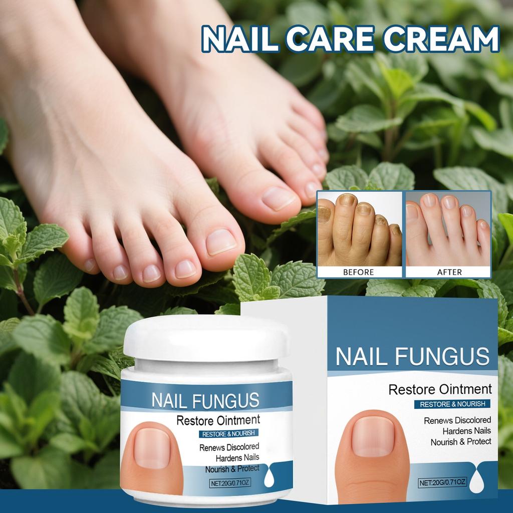 Onychomycosis Care Ointment, Nail Strengthening Cream, Nail Ointment To Strengthen Nails And Reduce Cracking