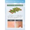 NALC lotion, highly moisturizing, heparin-like substance, sensitive skin, acne, rough skin, skin care, quasi-drug, 190mL