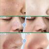 Crema Purificante Pori con Acido Salicilico Restringe i Pori Rimuove i Punti Neri Acne Illumina Idrata Pelli Lisce Cura della Pelle Prodotti Coreani
