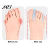 Flexible Toe Spacer 2PCS Gel Separator, Soft Flared Spreader Straightener, Ultra-Thin Non-Slip A-shaped Separator Comfortable Bunion Corrector,