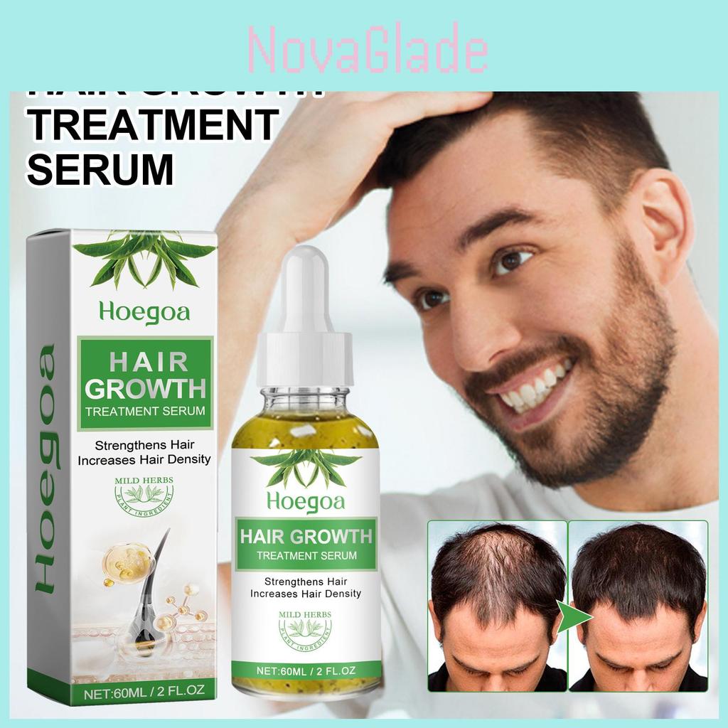 Hoegoa 60ml For Strong Resilient Hair With Natural Fragrance And Non-greasy Finish