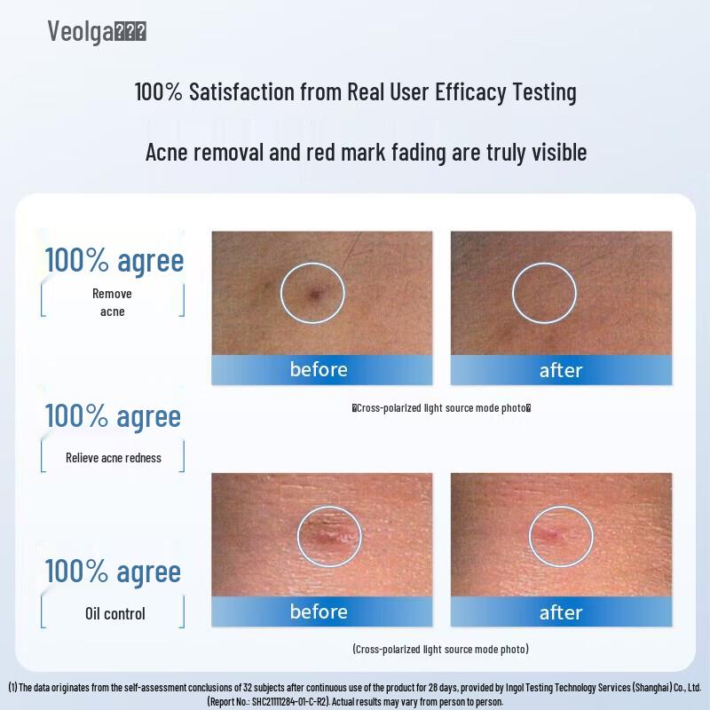 Fu Er Jia Hydrolyzed Sponge Acne Gel