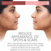 Rosehip Oil for Skin | Rosehip Seed Oil for Face | 100% Pure & Natural Essential Oil - 15 ML