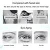 Nicotinamide Eyes Cream Dark Circles Remove Eye Bags Under Eye Hyaluronic Acid Moisturizing Serum Against Puffiness Eye Care Gel