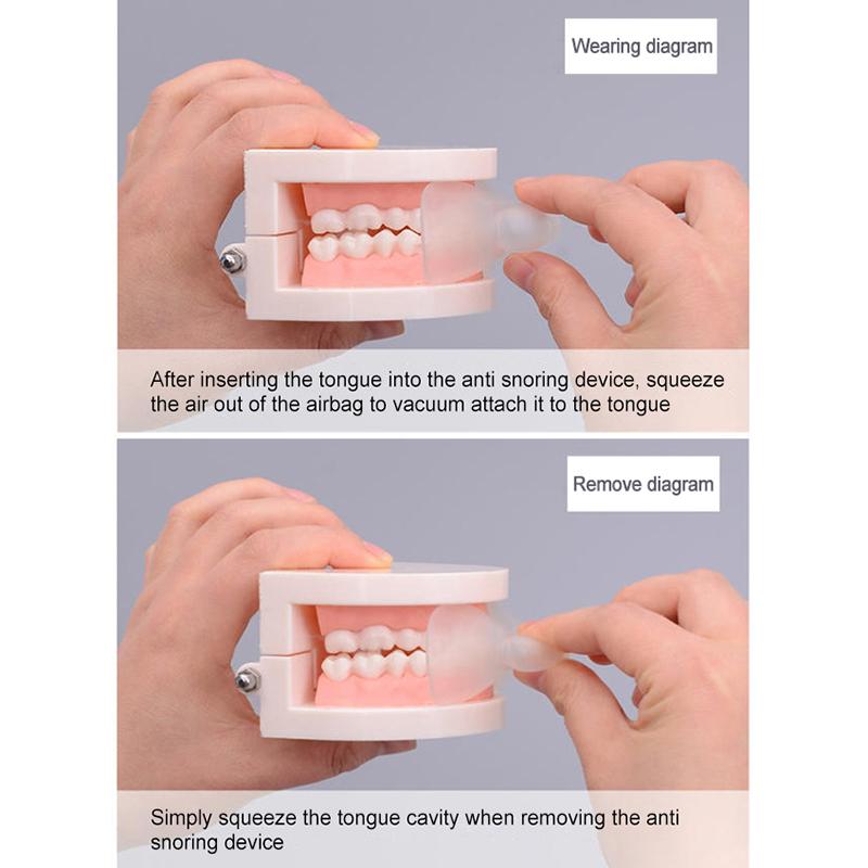 1Stk Anti-Schnarch Mundstück Gerät Zunge Medizinisch Silikon Schlafschutz Zungenhalter Atemhilfe Schnarchen Apnoe