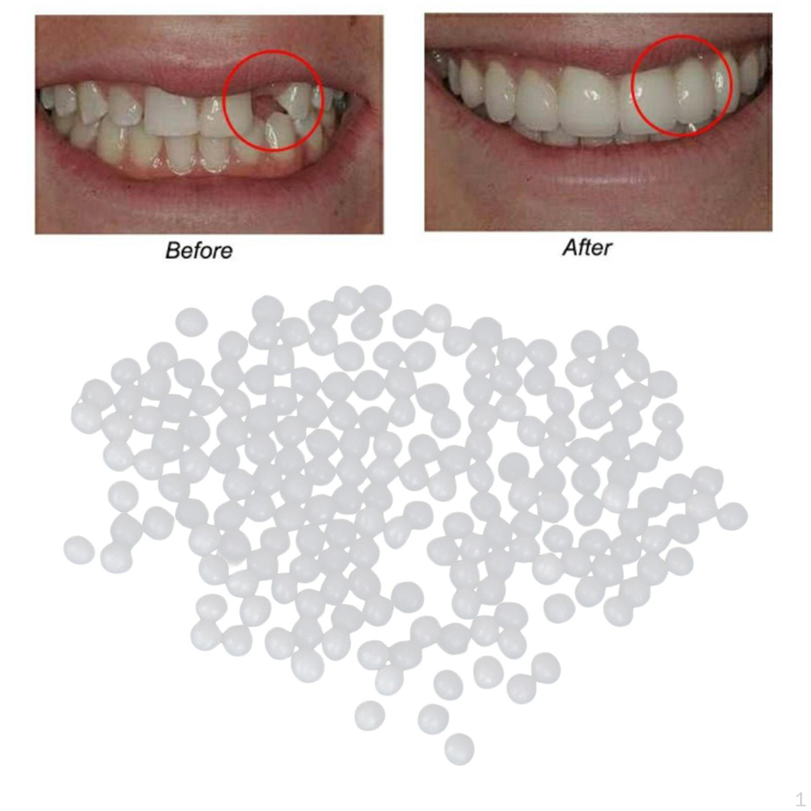 Наполнение термобусинами для временного ремонта отсутствующих или сломанных деталей, как глина в теплом состоянии, остывая, становится твердой. 10g_White