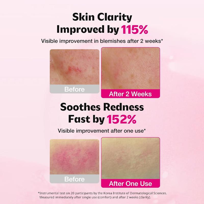 [ISOI] Blemish Care Up Serum 35ml