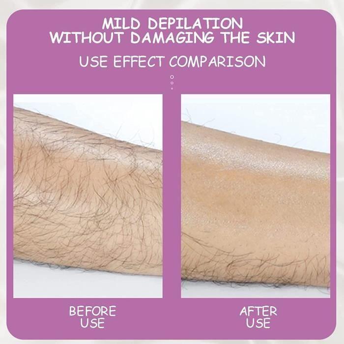Epilator - Crystal Hair Eraser - Physical Hair Removal - Painless - Exfoliation - Smooth Skin
