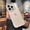 Star Glitter Transparent Phone Case for iPhone 17 Pro Max, 16/15 Pro, 14/13 - Precise Fit