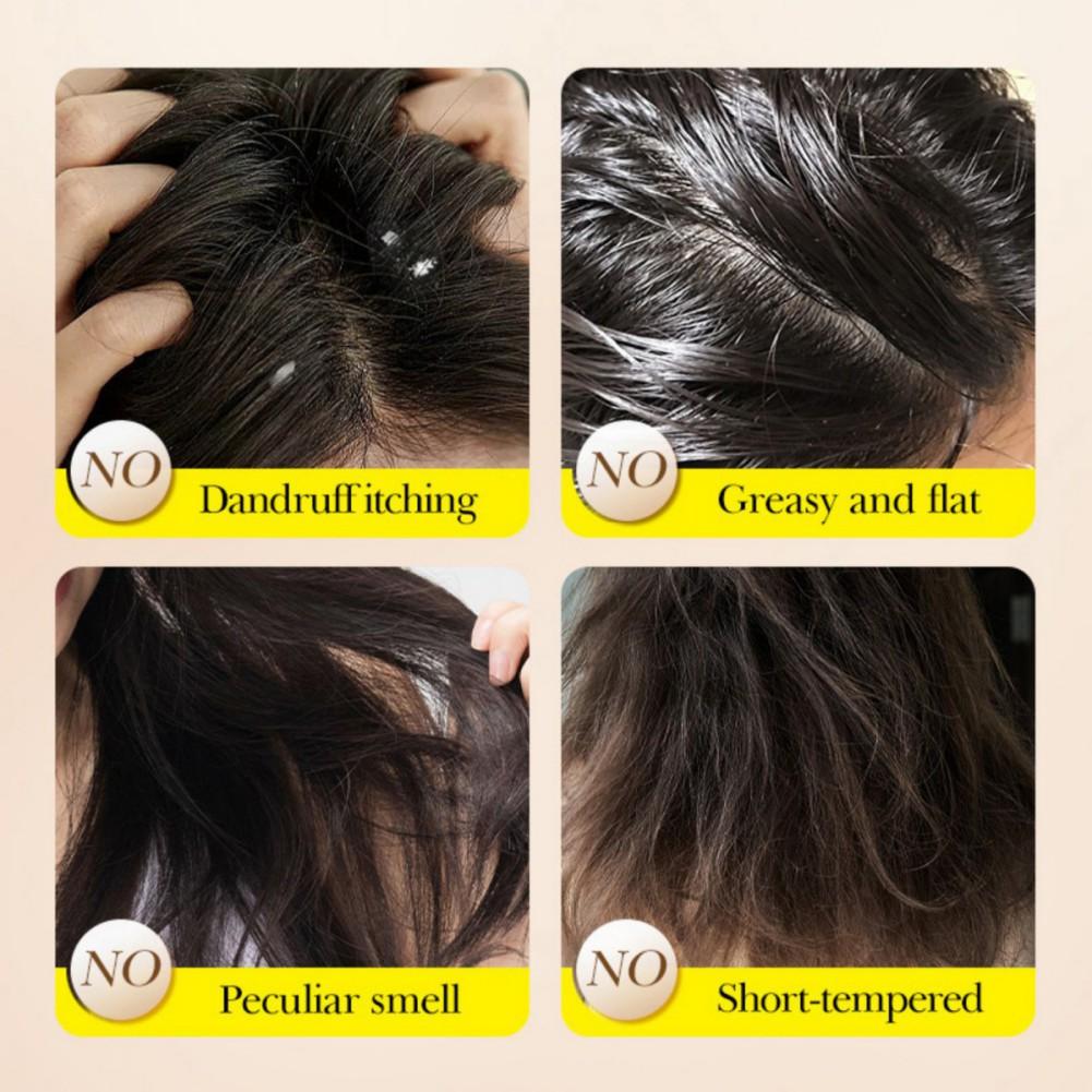 Shampoo-Seife, feste Shampoo-Seife, Tiefenreinigung/Ölkontrolle, flauschig/glatt/kräftige Haarwurzel/nährende Reparatur/Antischuppen
