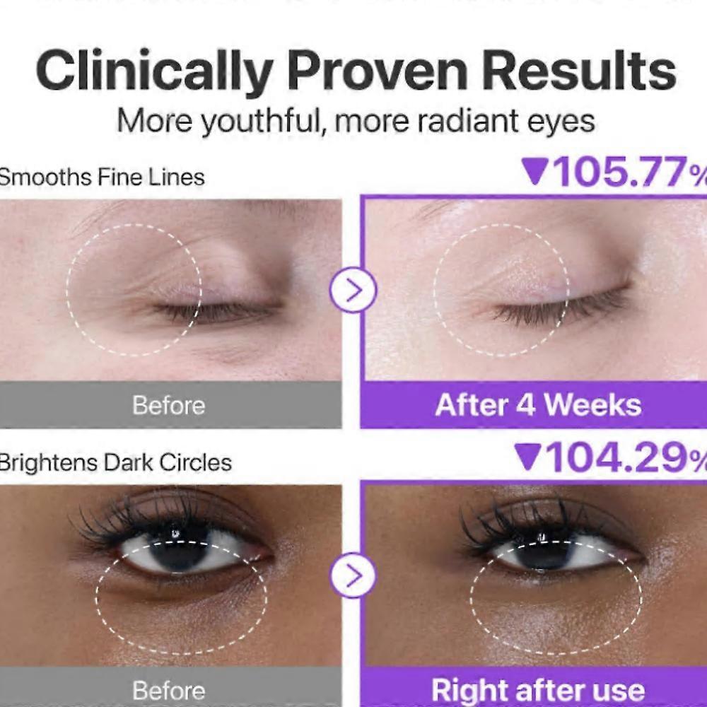 No.9 NAD+ Retinol Volumetox Eye Cream for Firming, Anti Wrinkles & Fine Lines, Remove Dark Circles