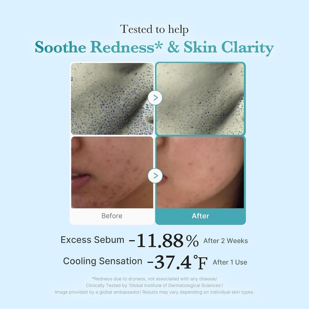 Medicube Azelaic Acid Niacinamide Clear Toner