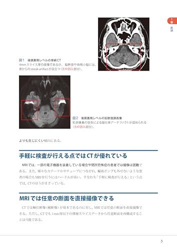 Mastering Head CT and MRI Imaging and Interpretation