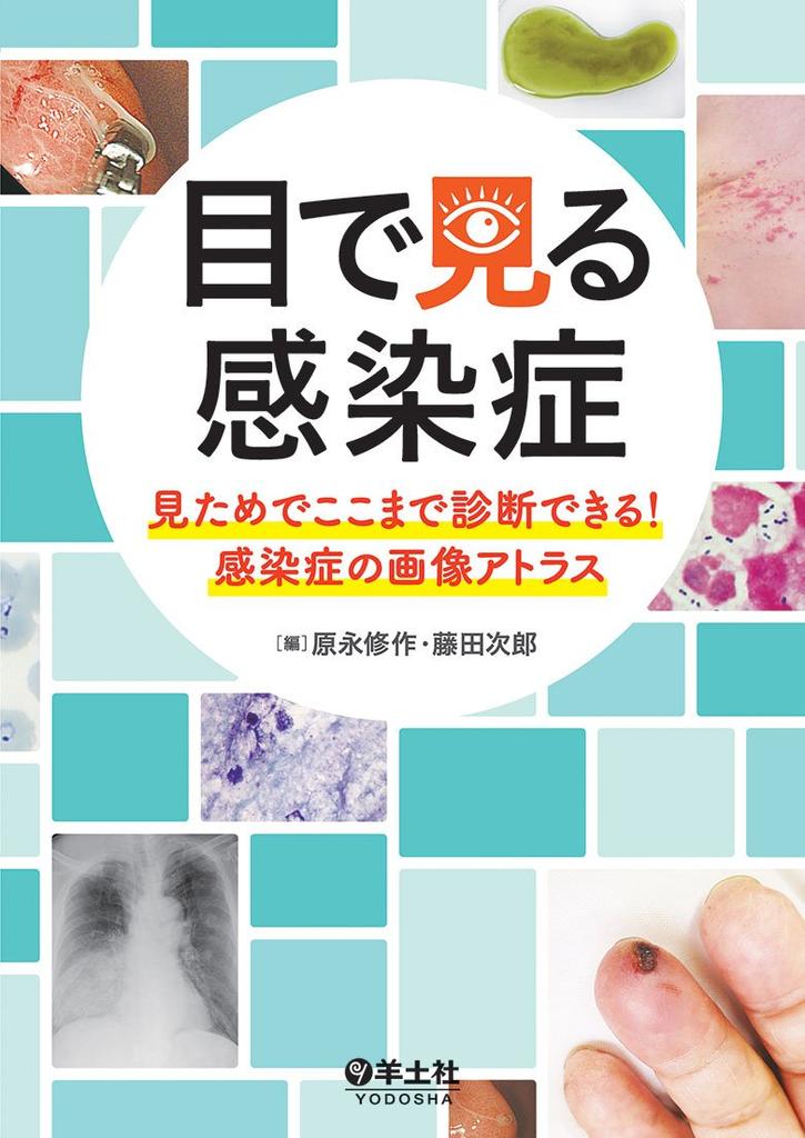 Visual Infectious Diseases: How Much Can You Diagnose by Appearance? An Atlas of Infectious Disease Images