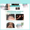 Wiyun Rosemary Hair Care Cream For Preventing Hair Loss And Enhancing Strength And Smoothness