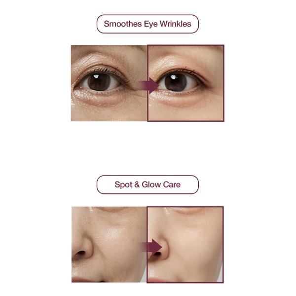 KI Cosmetics Stem-Cell Exosome Skin Booster Kit (30ml / 6ml × 5 Kits) (3 Options)