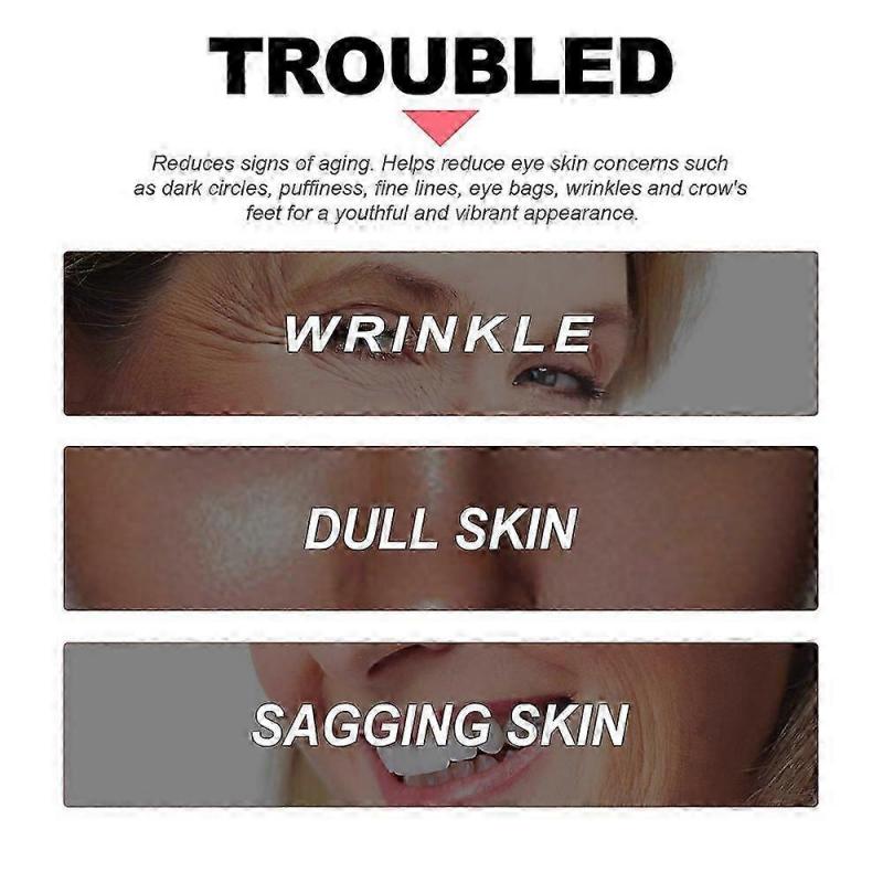 Retinol Anti-Wrinkle Eye Cream for Dark Circles & Puffiness, Anti-Aging Lifting Firming, Brightening Moisturizing Eye Care