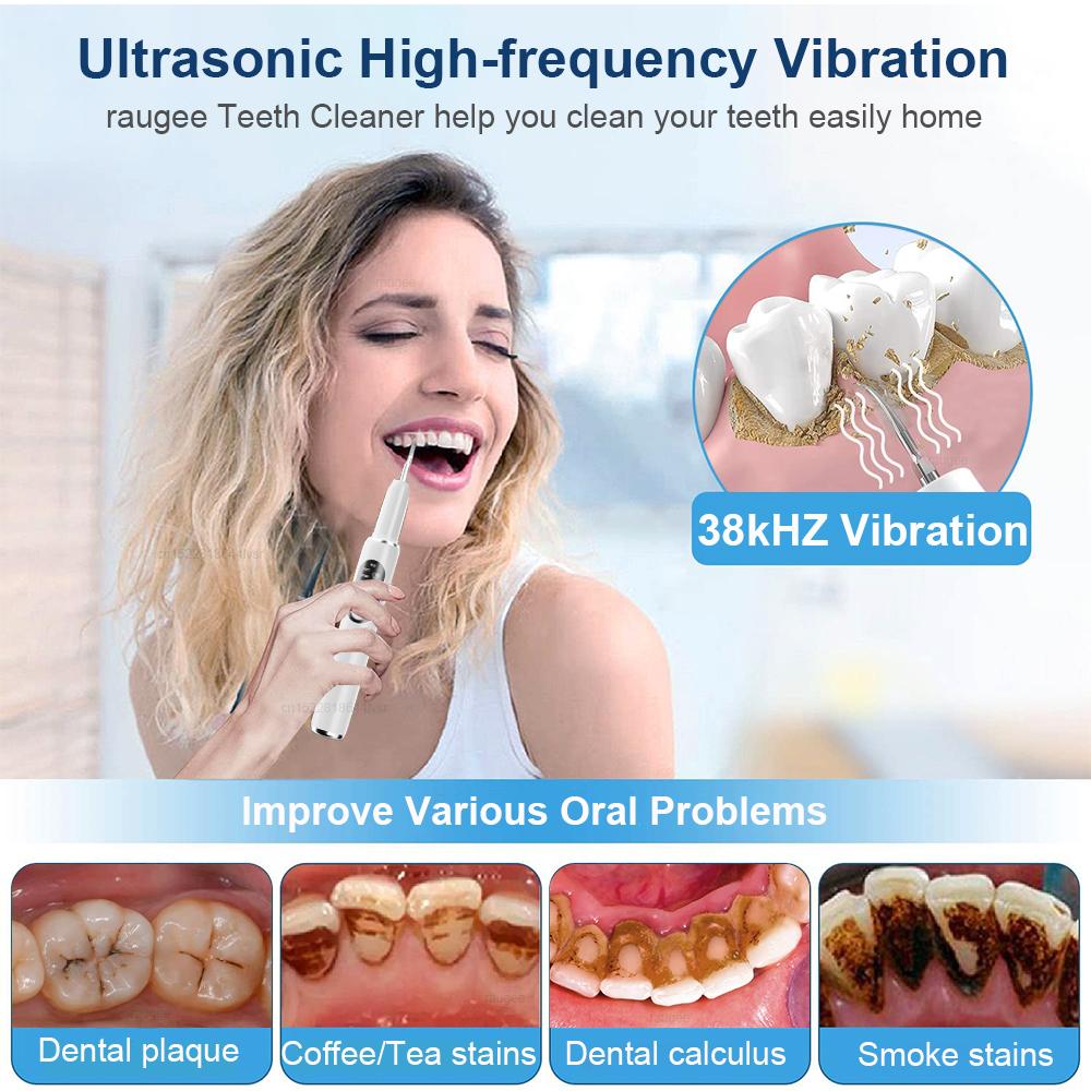 Ultraschall Zahnsteinentferner Zähne Zahnsteinentferner Dental Plaque Zahnsteinentferner Zahnsteinentfernung Ultraschall Zahnreiniger