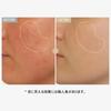 TOSOWOONG Real Rice Glow with Alpha and Ceramides for a Hydrating Glow for Dry and Combination by Korean Skincare Cosmetics Serum, 33ml, Niacinamide,