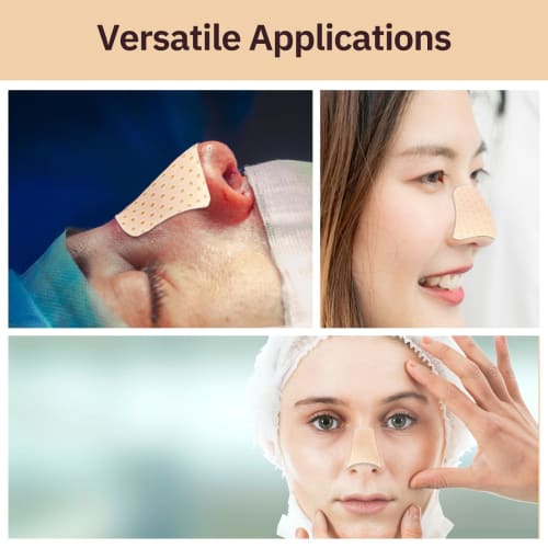 Ziimaikery Thermoplastic Nose Splint, Trapezoid Nose Brace Splint, External Nose Support Protector for Nose Brace Fracture, Rhinoplasty Septoplasty, E