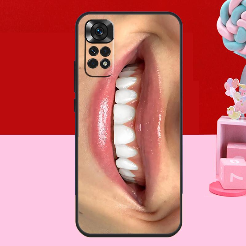 

Bear-y Cute Berry Jam Angels Case For Xiaomi Redmi Note 14 13 12 10 11 15 Pro Plus Redmi 15 C 10C 12C 13C 14C Soft Cover Redmi Note 15 5G