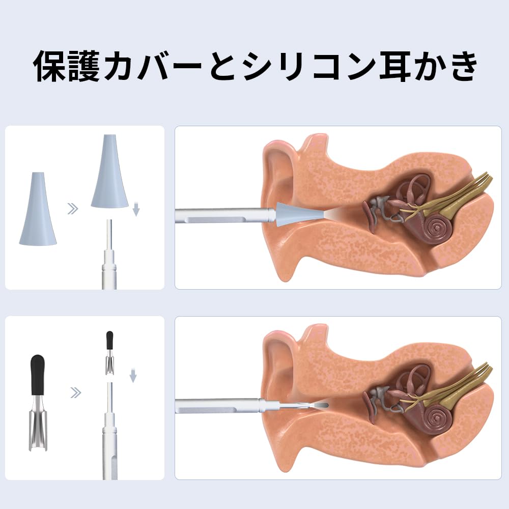 AMTORIN Ear Camera with 3.2mm Diameter, Includes Sterile-Packed Earpick Parts, 5-Inch IPS Monitor, IP67 Waterproof Ear Camera with LED Light, Earwax