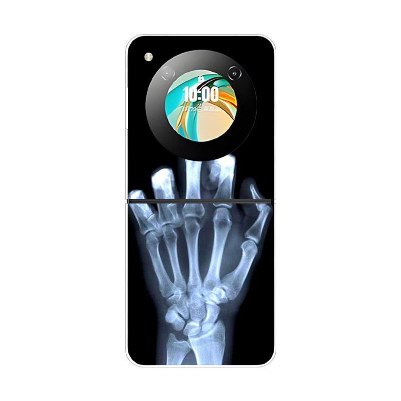 Etui For ZTE Nubia Flip NX724J Modne Malowane Przezroczyste Twarde PC Składane Pokrowiec For ZTE Libero Flip Przezroczyste Etui Funda