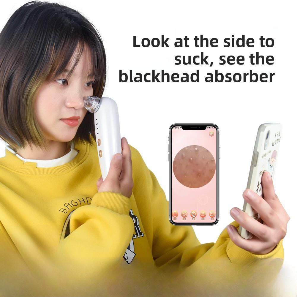 Visual APP Blackhead Absorber Cleans Facial Pores, Vacuum Extrusion, Electric Visual Blackhead Absorber