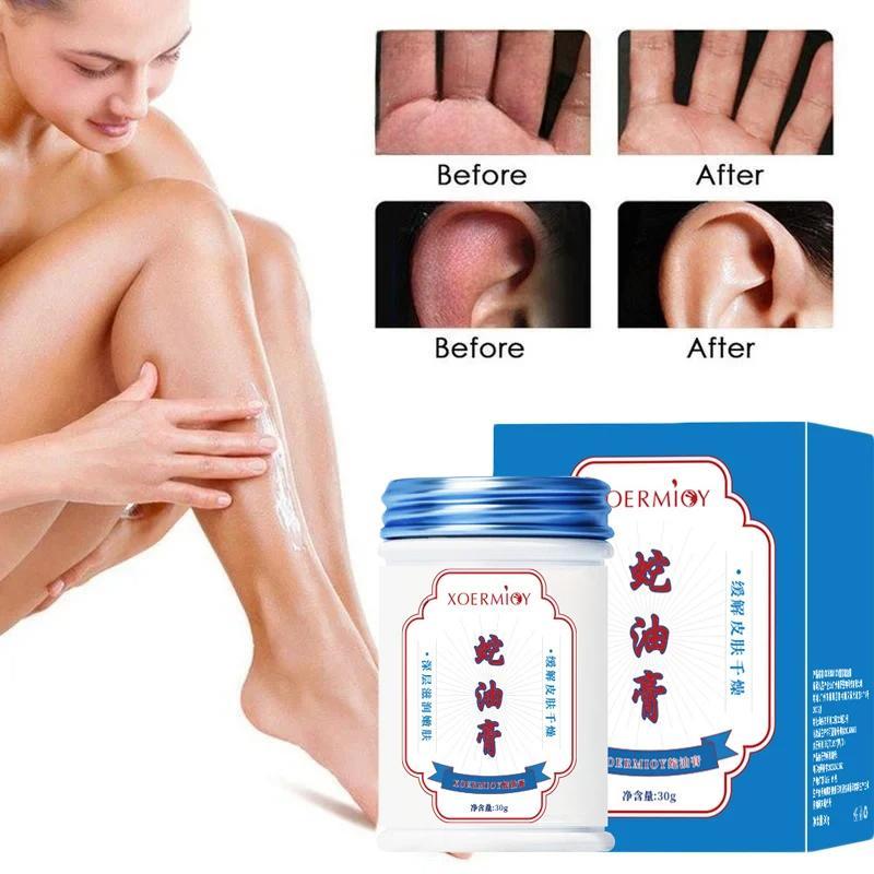 Snake Oil Moisturizing Cream for Dry Skin Relief Deep Hydration Body Balm for Cracked Skin Care 30g