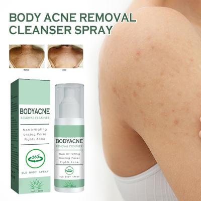Back Acne Spray,Acne Relief Spray,Back Acne Serum,Body Moisturiser For Acne,Reduce Back Acne & Body Acne,Back Scrub Deep Cleansing,(120ml)