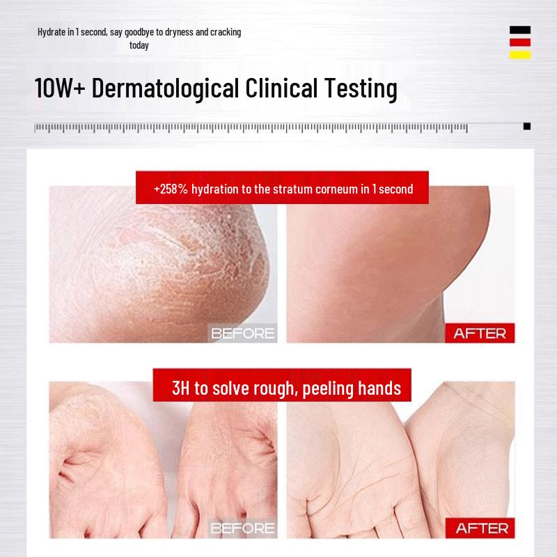 BEAI Cracked Heel & Hand Repair Cream