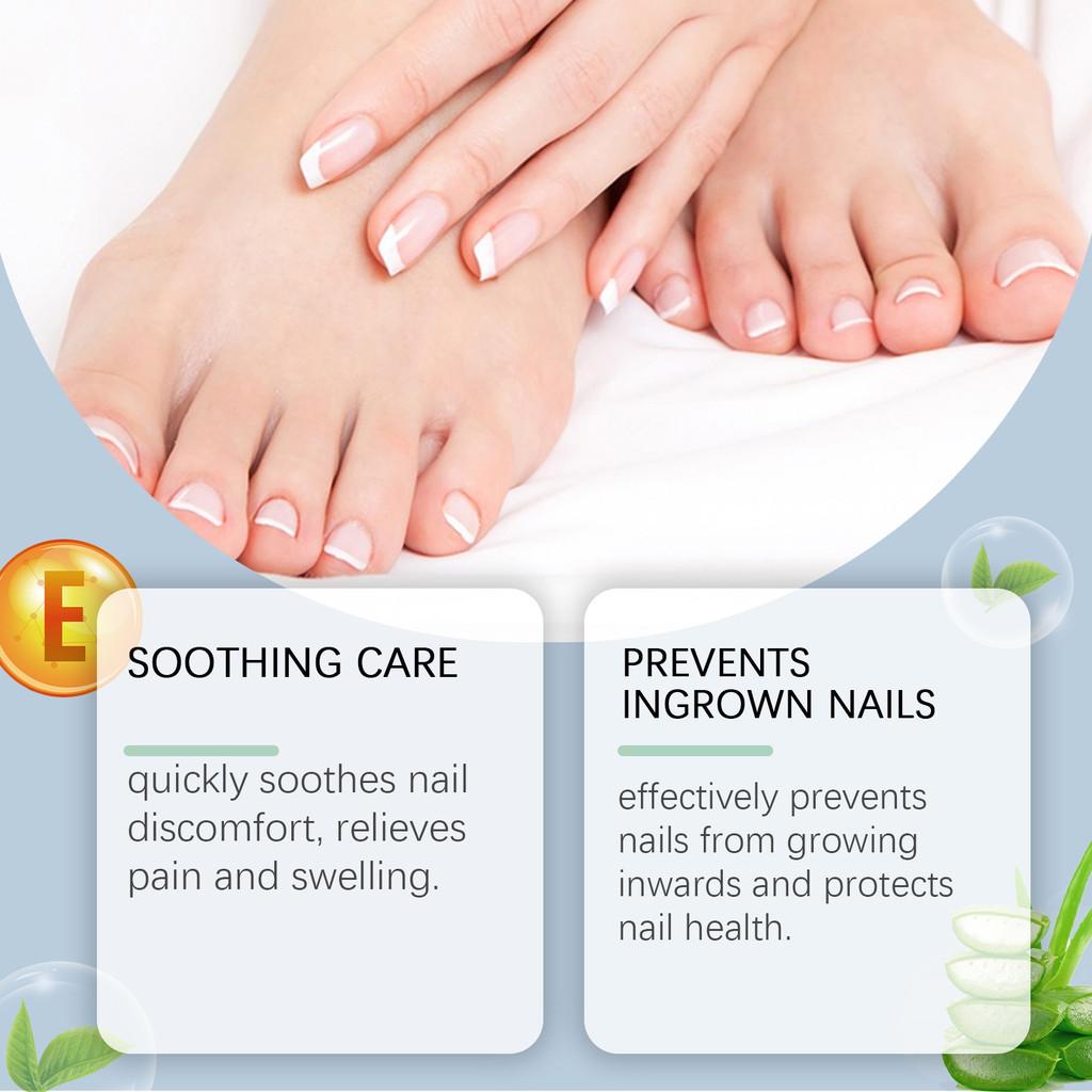 Nourishing Wiyun Nail Care Cream For Gentle Restoration And Shine Enhancing Treatment